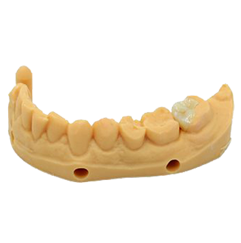 Inlays and Onlays placeholder