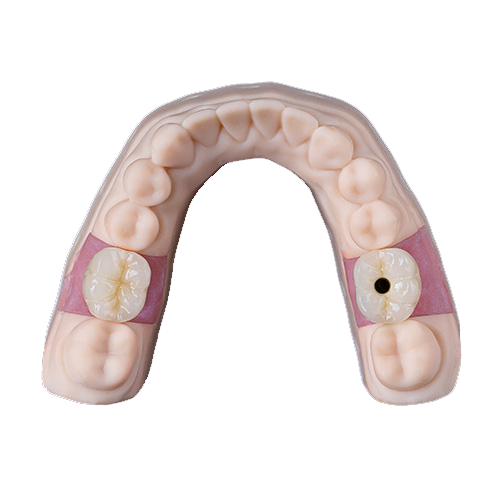 Case example placeholder