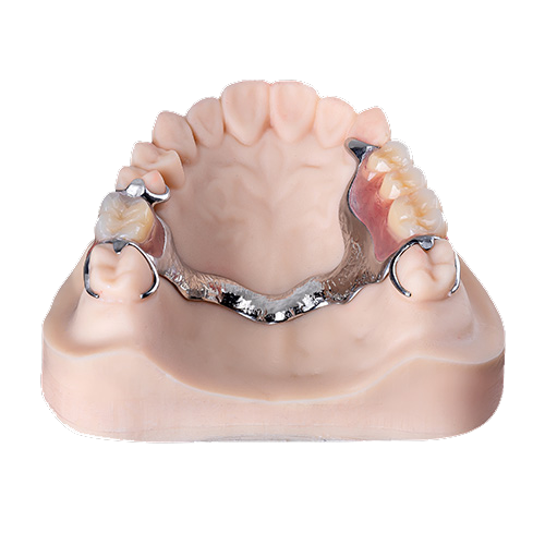 Full arch prosthesis placeholder