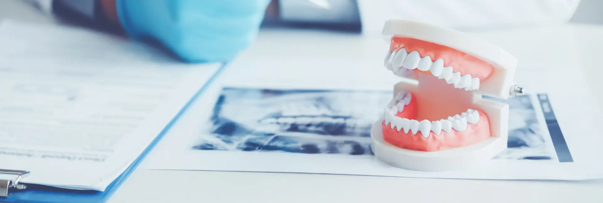 Dental fixed restoration workflow