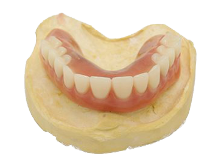 PFM restorations placeholder