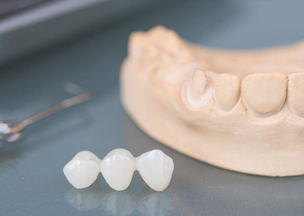Deyu Dental Lab Strengthens Position as Leading OEM Dental Partner for Global Brands