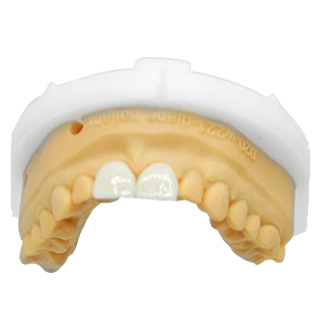 Material Wars: PFM Remains Relevant Amid the Zirconia Boom