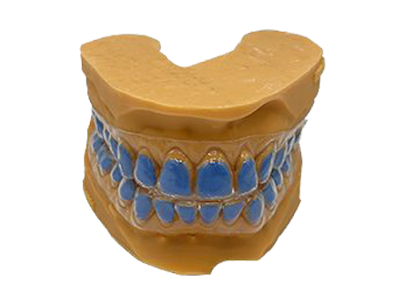 Quality Standards Take Center Stage in Implant Prosthetics